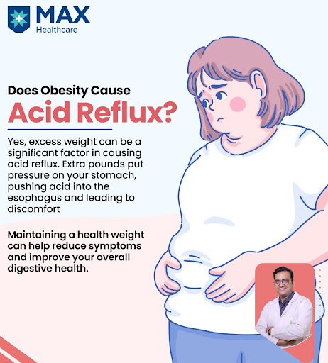🍔🔥 Curious about the link between obesity and acid reflux? Let's unravel the connection and explo… post image