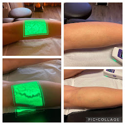 Photo n°2 de Dr BENZIMRA JEAN CHARLES PHLEBOLOGUE ANGIOLOGUE TRAITEMENT DES VARICES à Paris (Médecin)