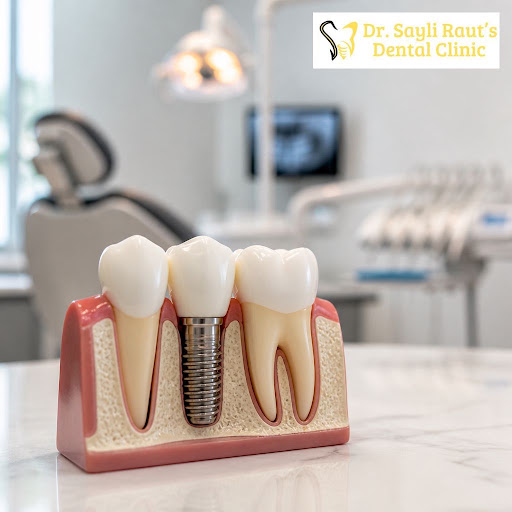 A chipped, missing, or painful tooth can affect your confidence every single day. At Dr Sayli Rau… post image