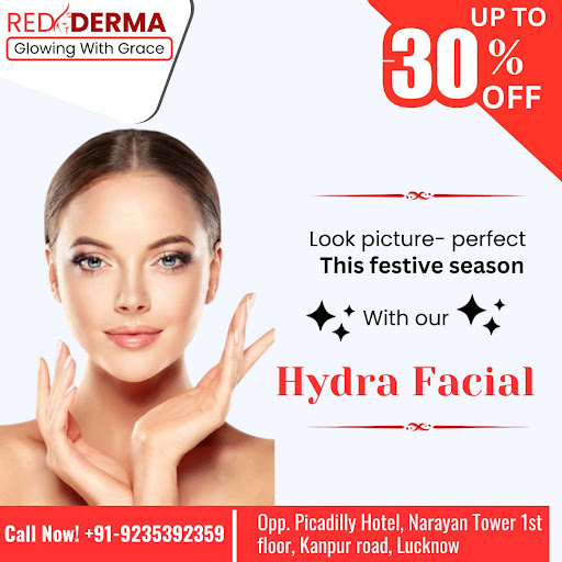 Social fastive offer 30% off post image