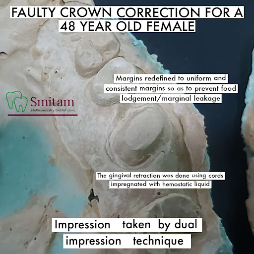 Sucess of a crown? post image