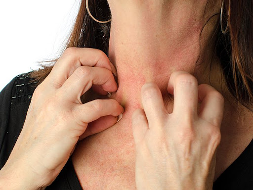 Suffering from itchy skin, redness, rashes, or allergic reac