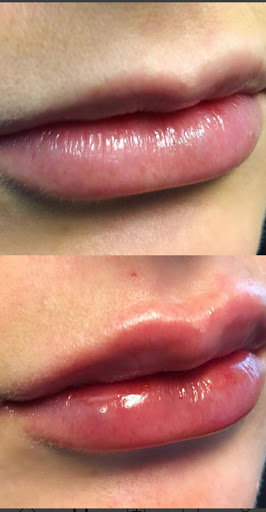 Advanced Skin and Body Solutions