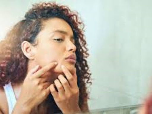 Pimple and Homeopathy Treatment post image
