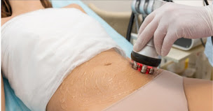 Photo n°1 de Studio Minceur à Caudry (Centre d'épilation laser)