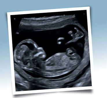 Pränatalzentrum Schleswig-Holstein Standort Flensburg