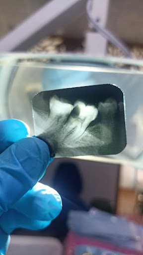 DENTAL CARMONA Gallery - Mexico