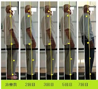 脊柱管狭窄症・ヘルニア専門 ときわバランス整体