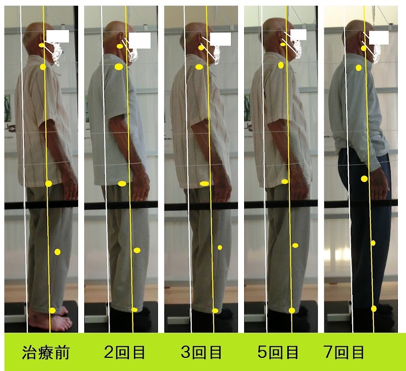 脊柱管狭窄症・ヘルニア専門 ときわバランス整体