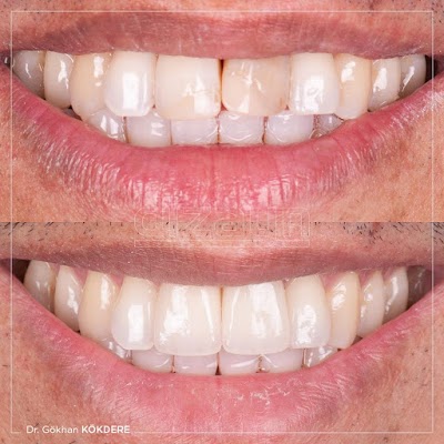 Photos of DENTAL DESIGN TURKEY (Dentist Antalya, Dental Treatments, Implants, Veneers, Smile Makeover, Cosmetic Dentistry)