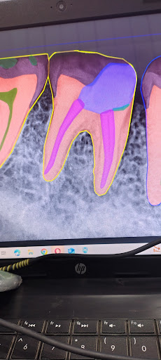 Colour full x ray only 100 rs. 