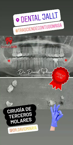 Dental Jallt - Dentista