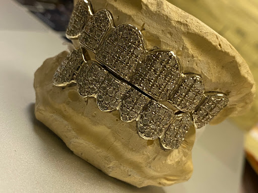 Gold 4 Ya Mouth - Thumbnail