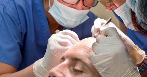 If you're struggling with hair loss or thinning, our Hair Transplant services are the solution yo…
