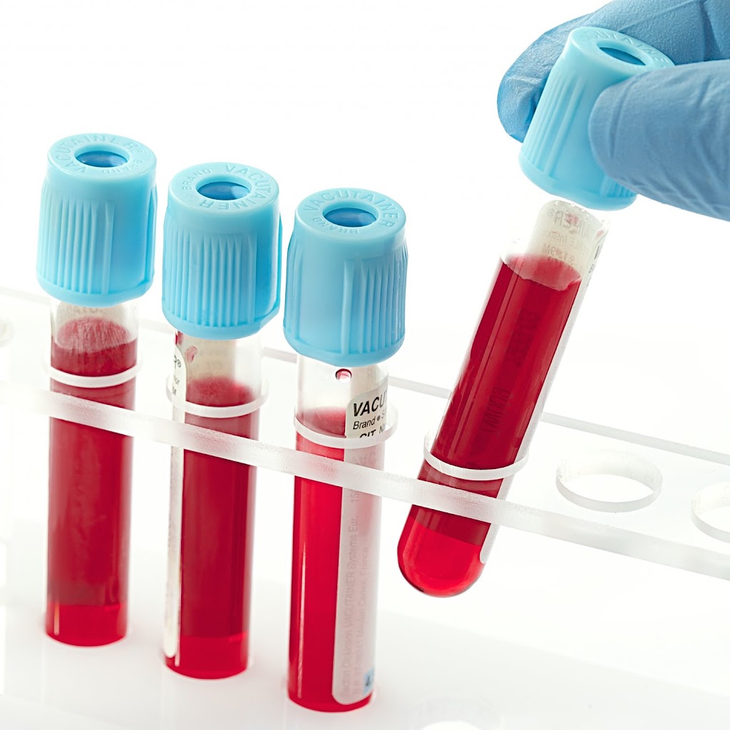 Ankush Diagnostic Lab