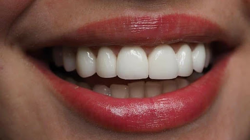 Othman Aljbawi Otodent Smile