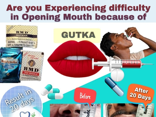 Apex Dental Gulbarga post image