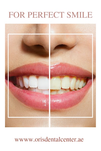 Photos of Oris Dental Center - Al khawaneej, Dental Implants, Dental Veneers & Hollywood Smile Specialist & Cosmetology