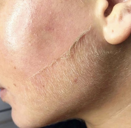 KYRASKIN Aesthetics & Acne Specialists - Thumbnail