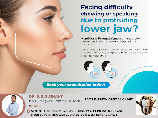 Mandibular prognathism, or an underbite, occurs when the lower jaw extends beyond the upper jaw.… post image