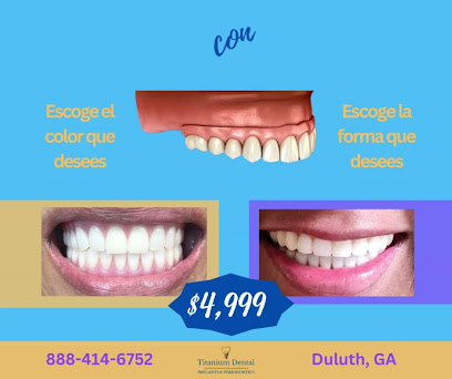 TITANIUM DENTAL Implants & Periodontics **$1,999 Implant Special** Best Price in GA!
