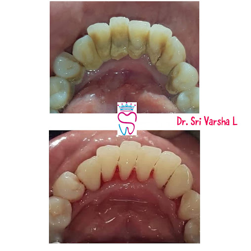 Af1qipnhmz 1hn1ugtkuricm7cuuednxmgf63wmpposq=s508 K No