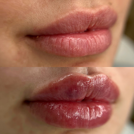 VNS Aesthetics, Nataliya Stavkovy, RN