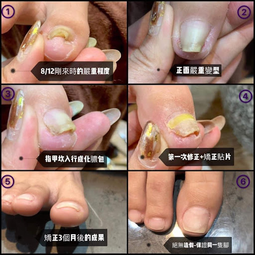 茉美甲凍甲評價、價格、網友推薦資訊 - 細心凍甲處理與親切服務