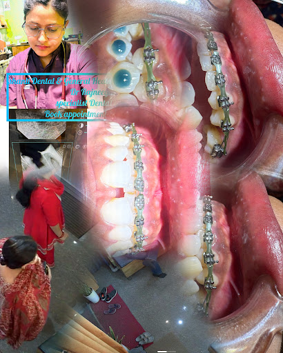 get ur confident smile today consultant specialist dental Doctor at shanti dental & General healt… post image