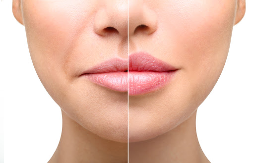 KC Injectables Med Spa