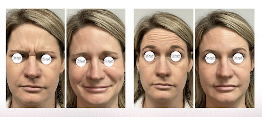 Wright Medical Aesthetics - Thumbnail