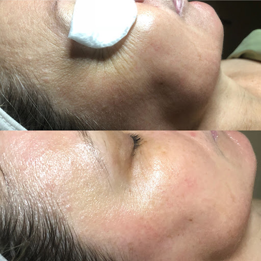 Carbon Beauty Bar - Thumbnail