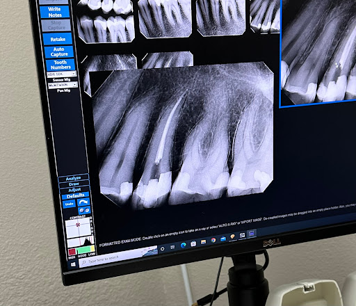 Kellogg Endodontics - Visual