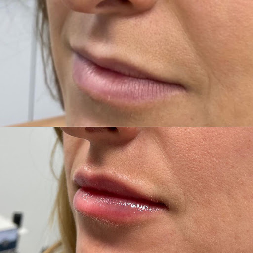 CMA - Center for Modern Aesthetic Medicine