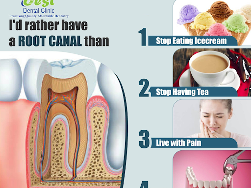 Root canal treatment is required when a tooth is fractured and a filling is not an option, maybe… post image