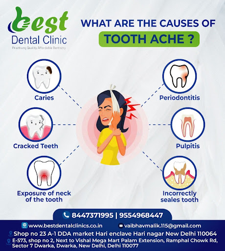 Best Dental Clinic, located in Dwarka Sector 7, is renowned for providing exceptional dental care… post image