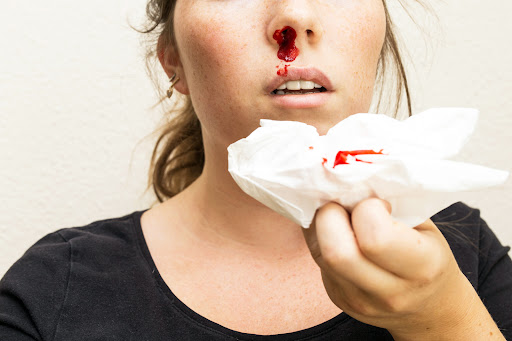 Understanding the possible causes of nose bleeding is important for receiving suitable care. An E… post image