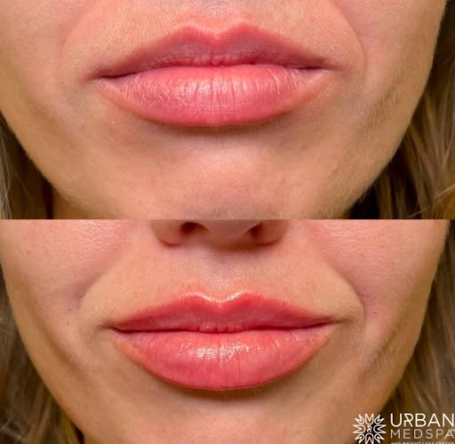 Urban Medspa & Weight Loss Center Charlotte