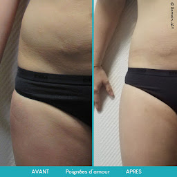 Photo n°5 de Cryolipolyse Diététicienne Nutritionniste - Neuilly - Jessica Haiun à Neuilly-sur-Seine (Programme de bien-être)