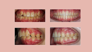 Photo n°16 de Dr MARUANI - Yvelines - Orthodontie spécialiste Enfants & Adultes à Le Vésinet (Orthodontiste)