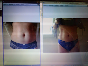 Photo n°19 de Lift and Corps à Beauvallon (Centre d'amincissement)