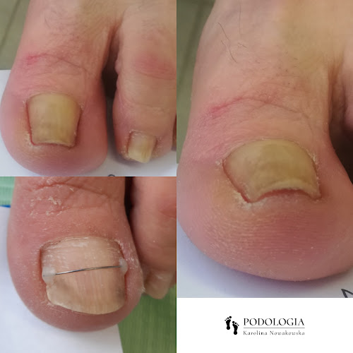 Podologia Karolina Nowakowska - Lekarz