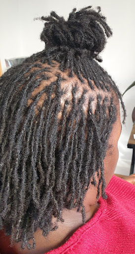 LOCs&CO