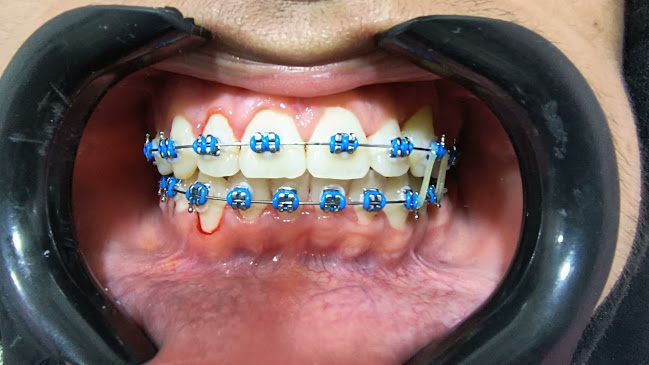 Medi Sanma Center- Clinica Dental -Pinar - Dentista