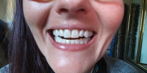 Absolute Dental - Topsy - Thumbnail