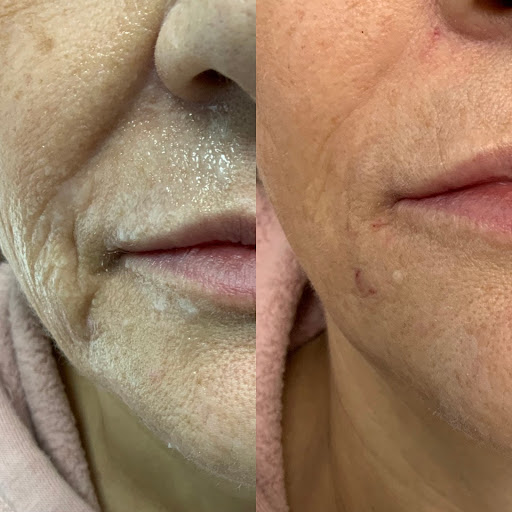 Bombshell Aesthetics and Laser