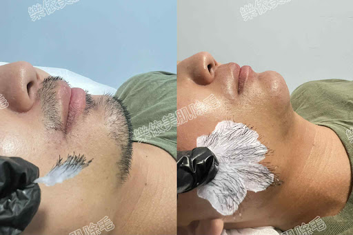 樂依 員林熱蠟美肌除毛 - 主要照片
