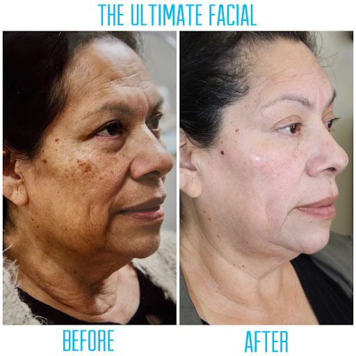 The Ultimate Facial - Thumbnail