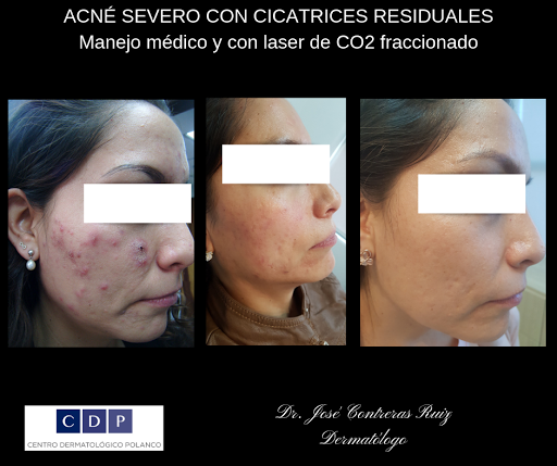 Dr. José Contreras Ruiz. Dermatólogo en Los Cabos - Thumbnail