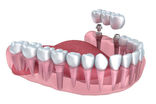 PearlFection Dentistry